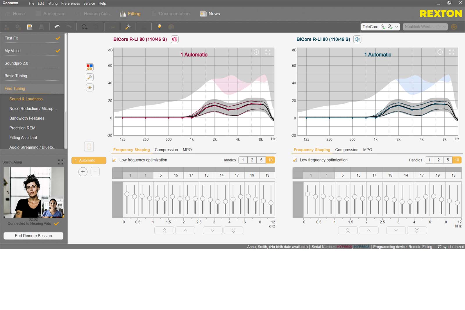 Connexx - fitting software for Rexton hearing aids | Rexton