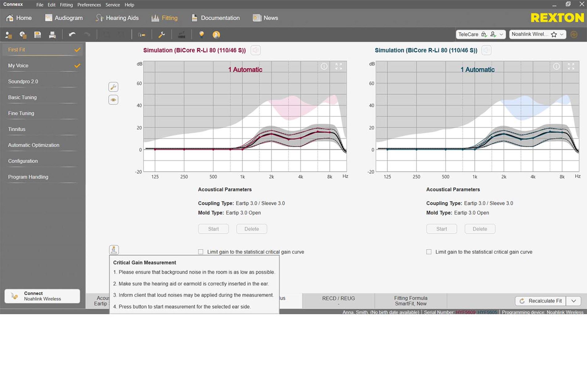 Connexx fitting software for Rexton hearing aids Rexton