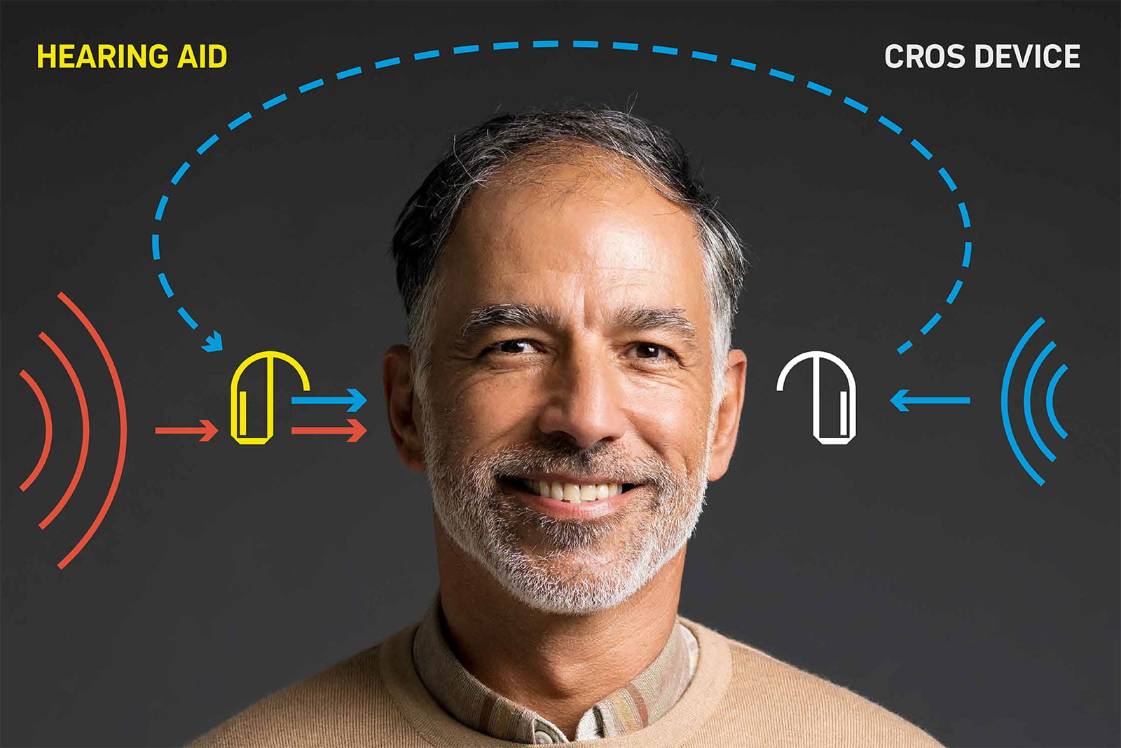 Rexton BiCROS solution